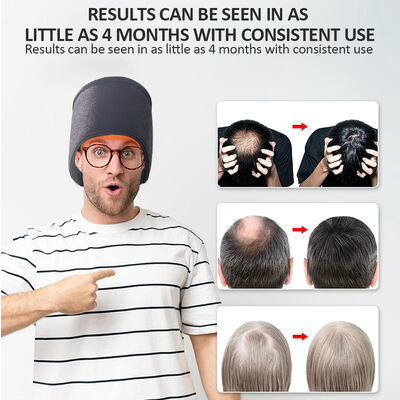 Gorra para el crecimiento del cabello de 660nm con terapia de luz roja LED y 270 LED de luz roja y gorra de terapia láser